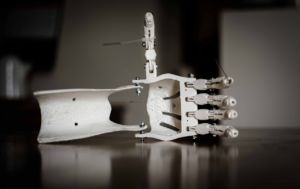 prótese mão impressão 3D